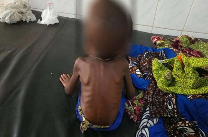  Lalo: Les enfants victimes de la malnutrition